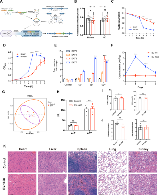 Depleting luminal cysteine with engineered bacteroides vulgatus alleviates experimental colitis by suppressing Th17 differentiation through an ATF6-dependent mechanism