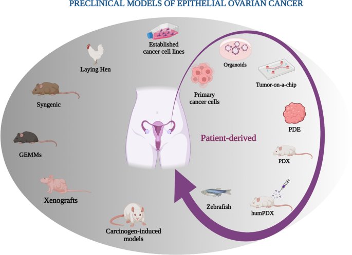 General Information About Ovarian Epithelial, Fallopian Tube, and Primary  Peritoneal Cancer