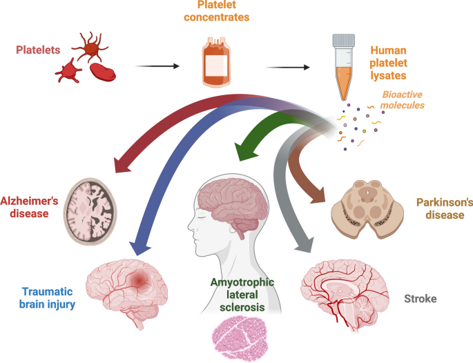 glutathione iv therapy nyc iv glutathione nyc Glutathione IV Therapy Treatment in Los Angeles