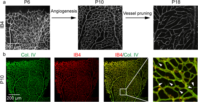 The role of blood flow in vessel remodeling and its regulatory mechanism  during developmental angiogenesis | Cellular and Molecular Life Sciences