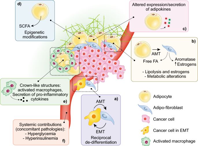 Cancer-associated adipocytes: emerging supporters in breast cancer, Journal of Experimental & Clinical Cancer Research