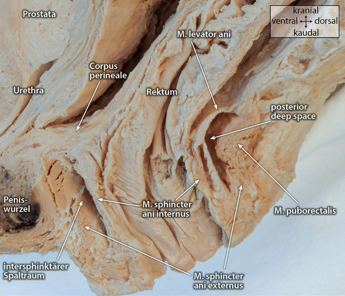 Klinische Anatomie der Anorektalregion in Bezug auf das Analfistelleiden |  coloproctology