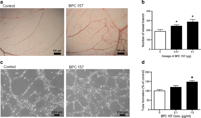 Therapeutic potential of pro-angiogenic BPC157 is associated with VEGFR2  activation and up-regulation | Journal of Molecular Medicine
