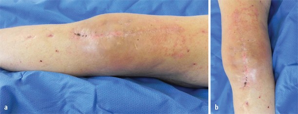 künstliches efeu hängend Künstlicher Hänge-Efeu - Kenan | 75 cm main image 1