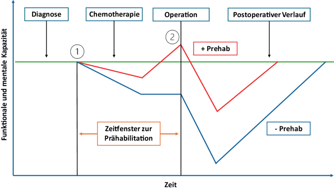 Prähabilitation und ERAS im Kontext urochirurgischer Eingriffe