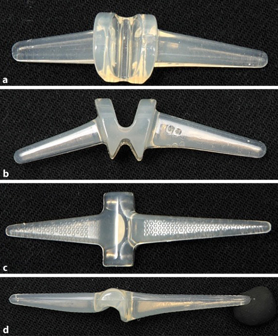Gelenkersatz am Fingermittelgelenk | Die Orthopdie | Springer Nature Link