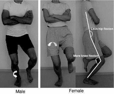 Differences in kinematics of single leg squatting between anterior cruciate  ligament-injured patients and healthy controls