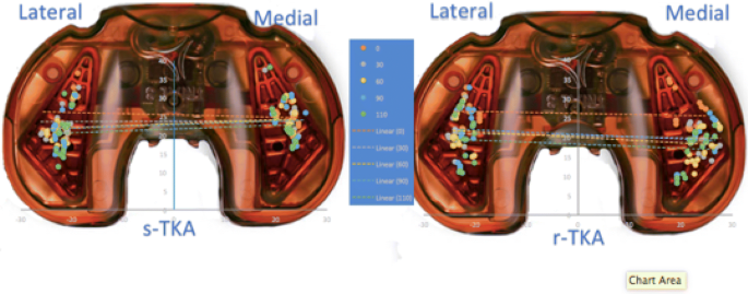 In Vitro Application of a Wireless Sensor in Flexion-Extension Gap Balance  of Unicompartmental Knee Arthroplasty