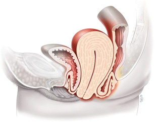Erratum to: An International Urogynecological Association (IUGA) /  International Continence Society (ICS) joint report on the terminology for  female pelvic organ prolapse (POP)