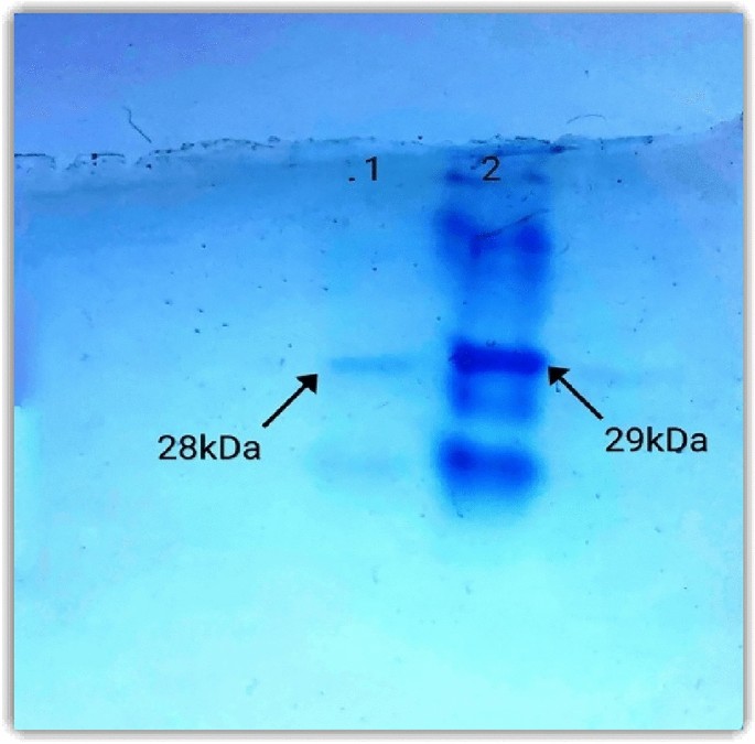 Comparison of AaL active site with AiiA, AiiB, and AidC. (A