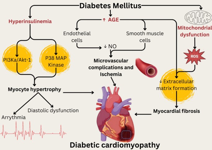 glutathione side effects on heart A comprehensive review on diabetic cardiomyopathy (DCM): histological  spectrum, diagnosis, pathogenesis, and management with conventional  treatments and natural compounds | Naunyn-Schmiedeberg's Archives of  Pharmacology