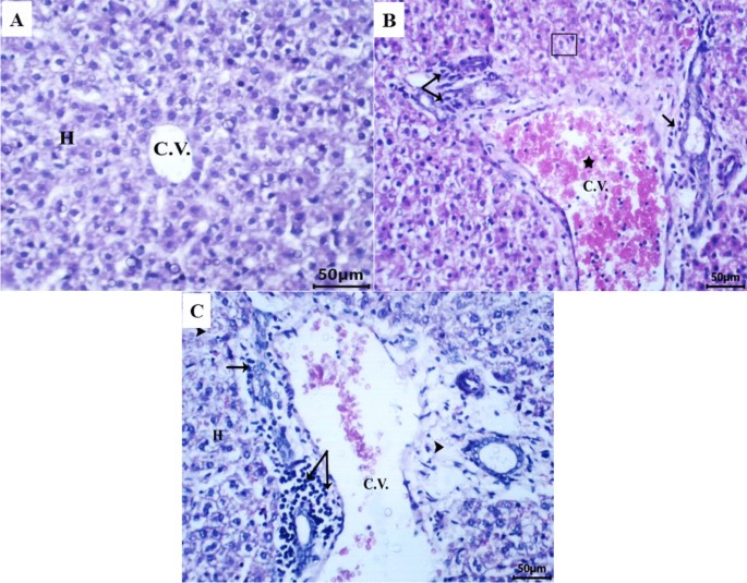 can glutathione pass through breast milk Linezolid administration to lactating Wistar rats affects the health of their offspring | Naunyn-Schmiedeberg's Archives of Pharmacology