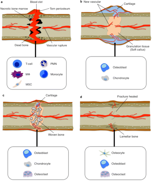 glutathione and msm dr berne Role of Nrf2 in Fracture Healing: Clinical Aspects of Oxidative Stress | Calcified Tissue International Wound dressing New Luxxe White Ultima Type:IM
