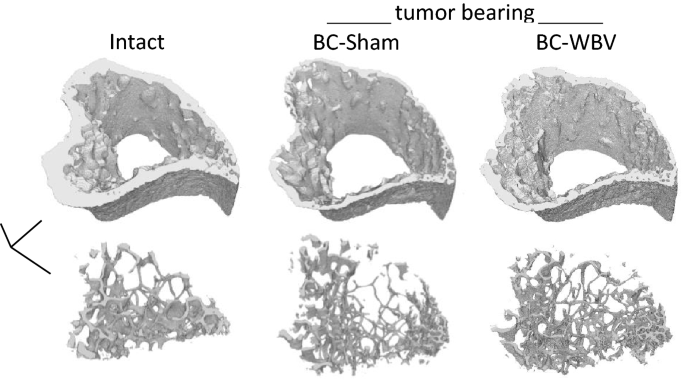 Effects of Whole-Body Vibration on Breast Cancer Bone Metastasis and Vascularization in Mice | Calcified Tissue International
