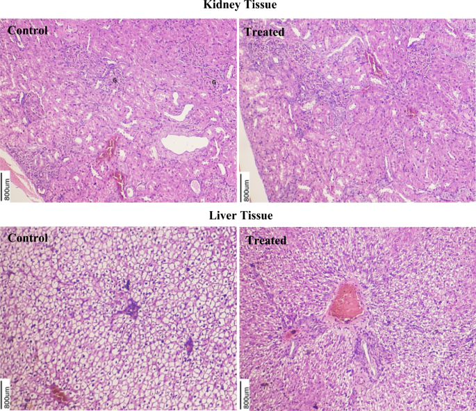 does glutathione cause kidney stones Nephroprotective effect of PHYMIN-22 on ethylene glycol induced urolithiasis rat model | Urolithiasis