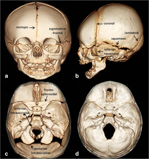 Skull base development and craniosynostosis | قاعدة الجمجمة عند الجنين
