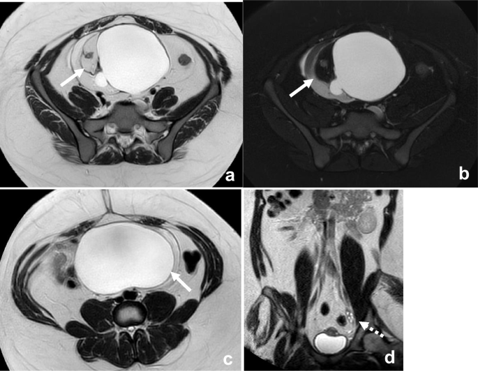 Rapid, free-breathing non-contrast MRI for first-line imaging