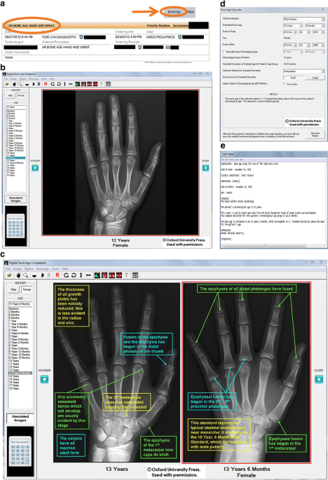 Skeletal development of the hand and wrist: digital bone age companion—a  suitable alternative to the Greulich and Pyle atlas for bone age  assessment? | Skeletal Radiology