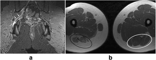 Sciatic Nerve : Wheeless' Textbook of Orthopaedics