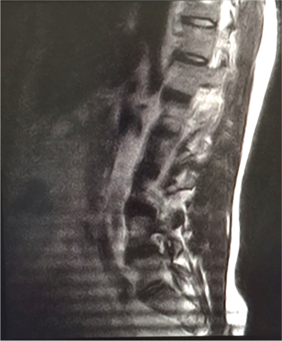 Belly Up or Down What are we missing? Prone vs. Supine MRI