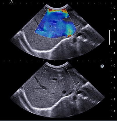 https://media.springernature.com/m685/springer-static/image/art%3A10.1007%2Fs00261-014-0305-8/MediaObjects/261_2014_305_Fig20_HTML.jpg