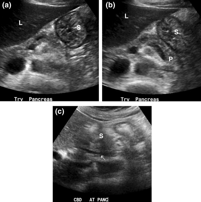 The Role of Sonographic Imaging to Assess the Pathophysiology of