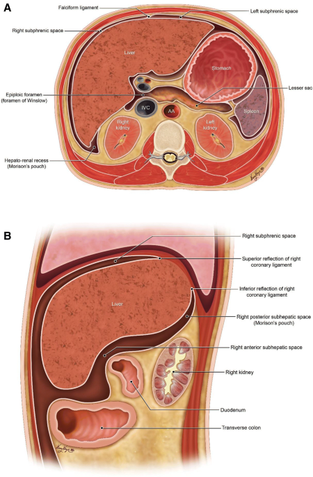 Morison's pouch: anatomical review and evaluation of pathologies