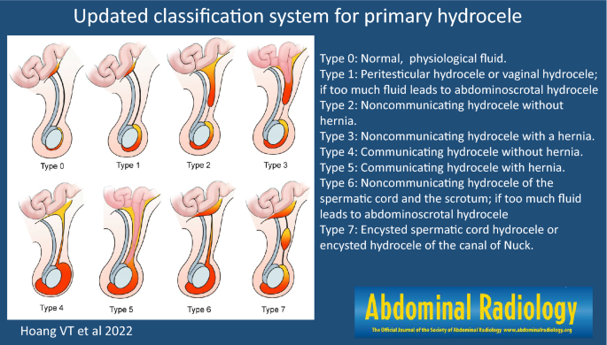 Updated classification system for primary hydrocele | Abdominal Radiology