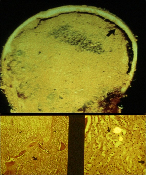 Why are our bones full of fat? The secrets of bone marrow adipose