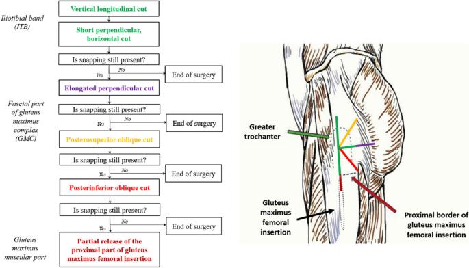 Gluteal Complex is important in External Snapping Hip