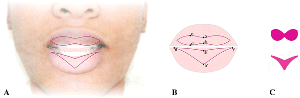c shape lips C-SHAPE FILLER woman with a C shape