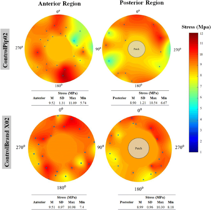 Mechanical Performance of Poly Implant Prosthesis (PIP) Breast