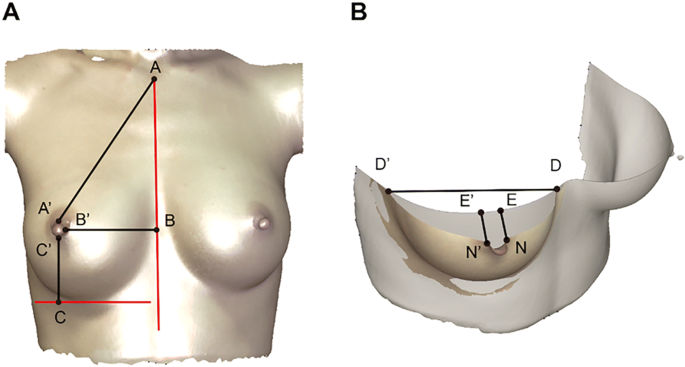 What Makes a Difference? Three-Dimensional Morphological Study of