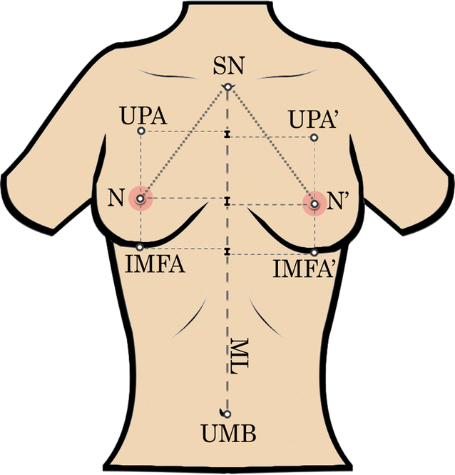 A New Tool for Breast Anthropometric Measurements: Presentation and  Validation for Women and Men