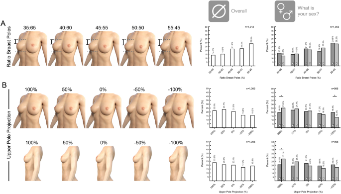 Fitlovely - WHAT IS 45:55 RATIO? HOW THAT'S RELATE TO YOUR BREAST? 87% of  people worldwide agree that the Beckoning Breast' with a youthful, natural  shape and an upper to lower ratio