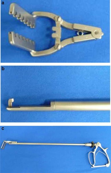 Figure 3 from A modified efficient purse-string stapling technique (mEST)  that uses a new metal rod for intracorporeal esophagojejunostomy in  laparoscopic total gastrectomy. | Semantic Scholar