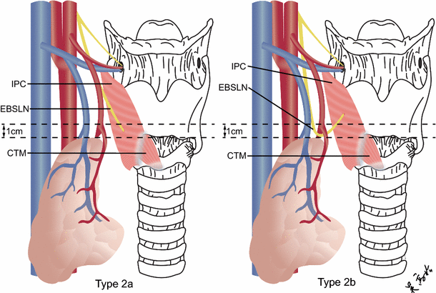 Surgical anatomy of the external branch of the superior laryngeal