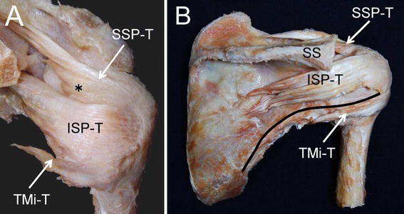 An anatomical study of the transverse part of the infraspinatus muscle that  is closely related with the supraspinatus muscle | Surgical and Radiologic  Anatomy