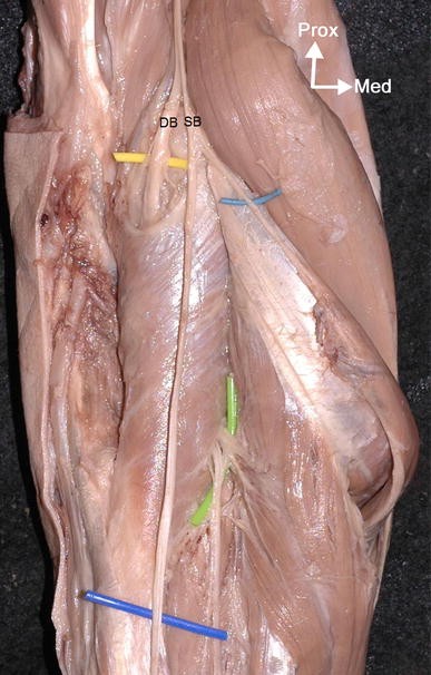 The supinator muscle: anatomical bases for deep branch of the radial nerve  entrapment | Surgical and Radiologic Anatomy