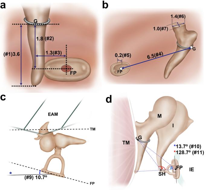 Detail of stapes human middle ear bone - Stock Image - C005/8798