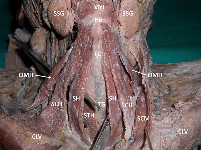 Sternocleidohyoid muscle: an unreported variant of cleidohyoid muscle |  Surgical and Radiologic Anatomy