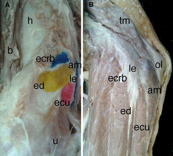 The anconeus muscle revisited: double innervation pattern and its clinical  implications | Surgical and Radiologic Anatomy