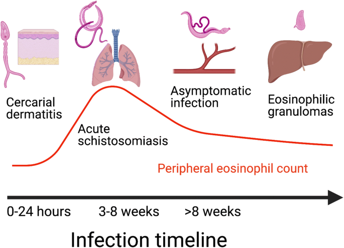 eosinophilia and glutathione The systemic treatments for drug reaction with systemic symptoms (DRESS) beyond corticosteroids 9 Health Benefits of Glutathione