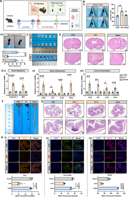 Restoring Firmicutes-Associated Metabolites: A Gut-Brain Axis Approach to Alleviate Neuroinflammation and Oxidative Stress in Intracerebral Hemorrhage | Current Microbiology | Springer Nature Link Restoring Firmicutes-Associated Metabolites: A Gut-Brain Axis Approach to Alleviate Neuroinflammation and Oxidative Stress in Intracerebral Hemorrhage | Current Microbiology | Springer Nature Link