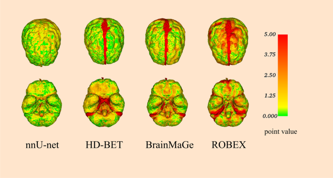 Dice comparison of 3D-UNet with BSE, ROBEX and Kleesiek's method on a