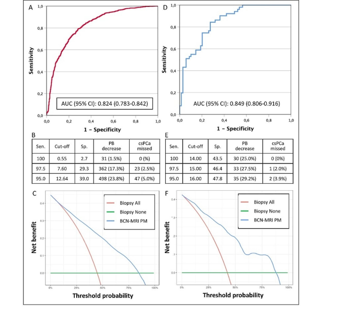 External validation of the barcelona magnetic resonance imaging predictive model for detecting significant prostate cancer including men receiving 5-alpha reductase inhibitors