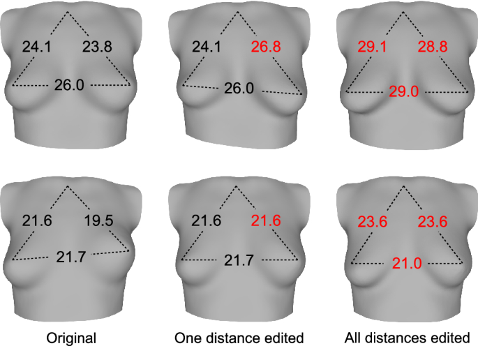 Learning the shape of female breasts: an open-access 3D statistical shape  model of the female breast built from 110 breast scans