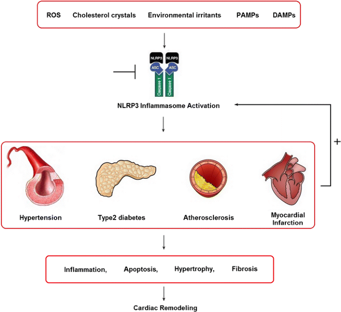 Activation of NLRP3 inflammasome accelerates atherosclerosis. In