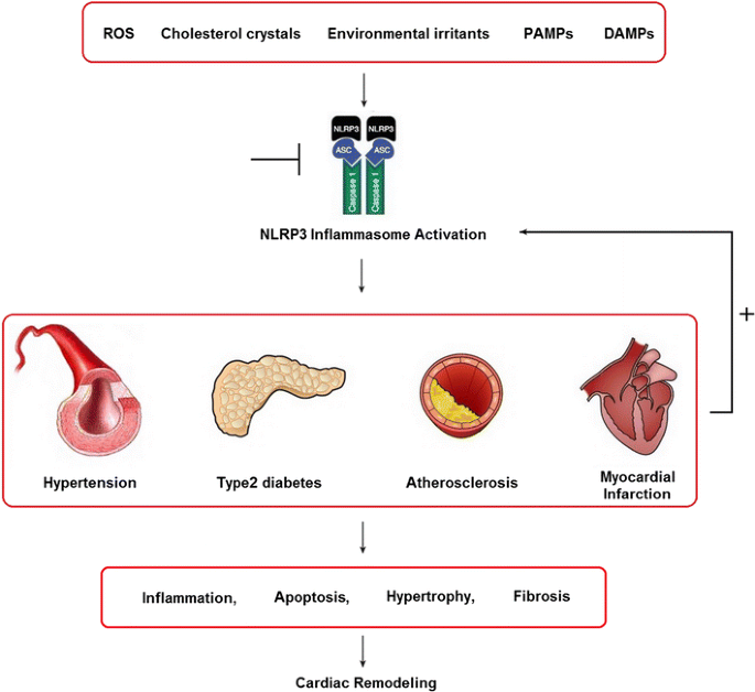 Role of NLRP3 inflammasome in the pathogenesis of cardiovascular