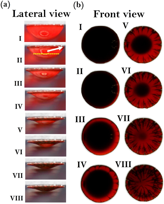 The ring phenomenon of diluted blood droplets